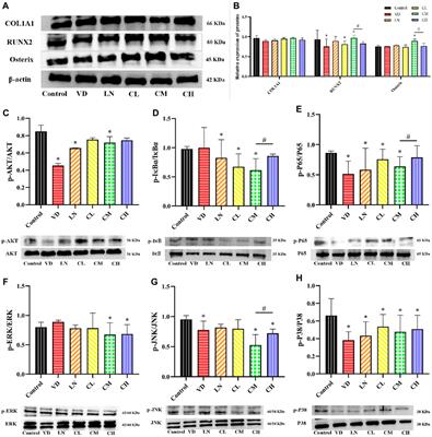 Caffeine regulates both osteoclast and osteoblast differentiation via the AKT, NF-κB, and MAPK pathways